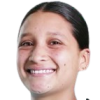Martinez